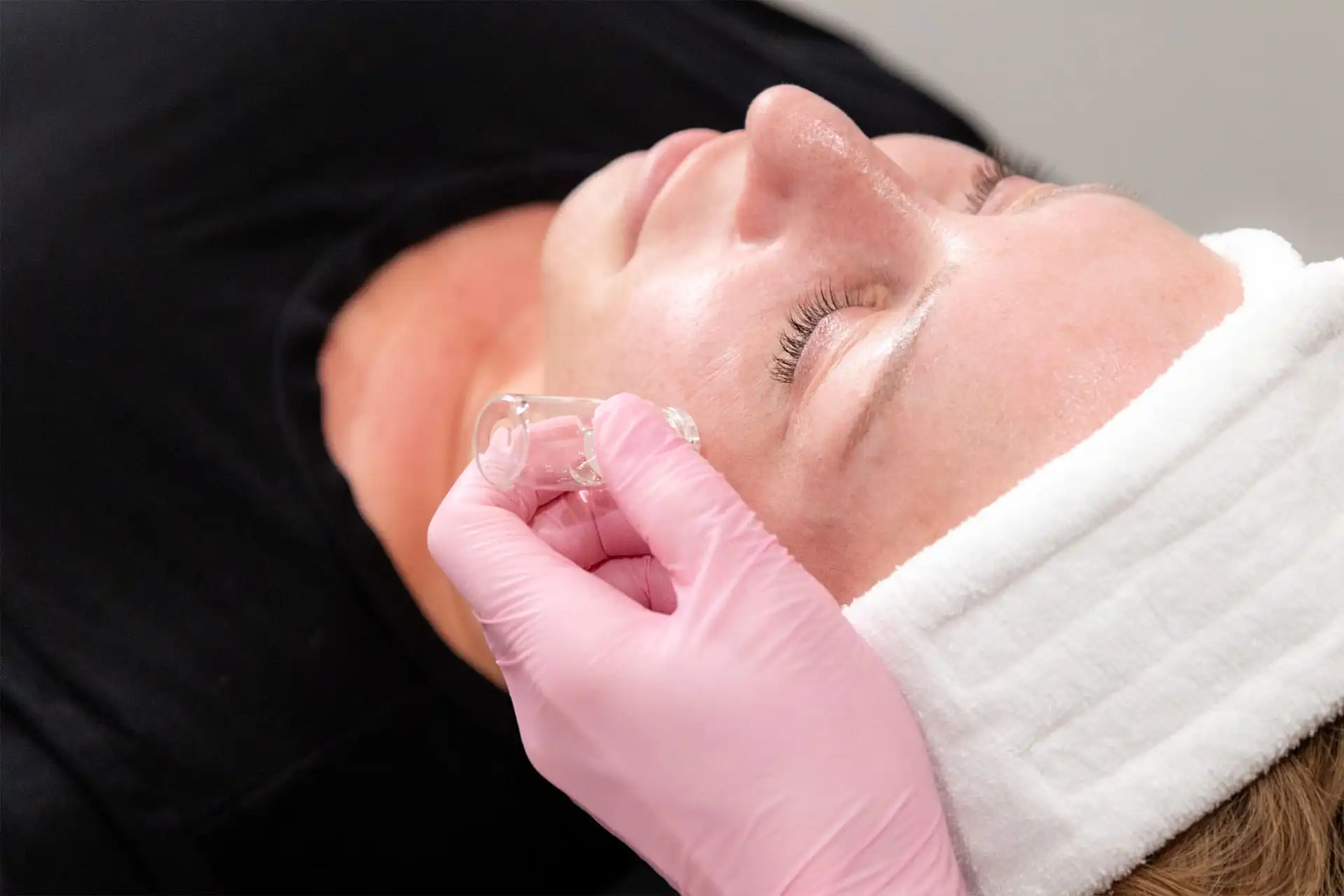 Facial for Hyperpigmentation Queens NY – Brighten and Even Your Skin Tone
